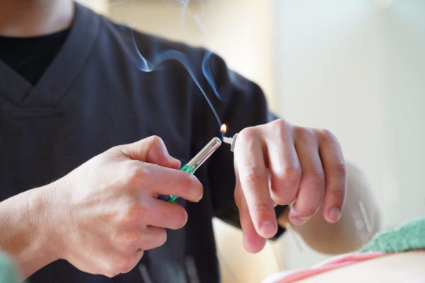 Moxibustion