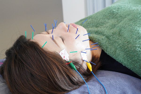 electric beauty acupuncture