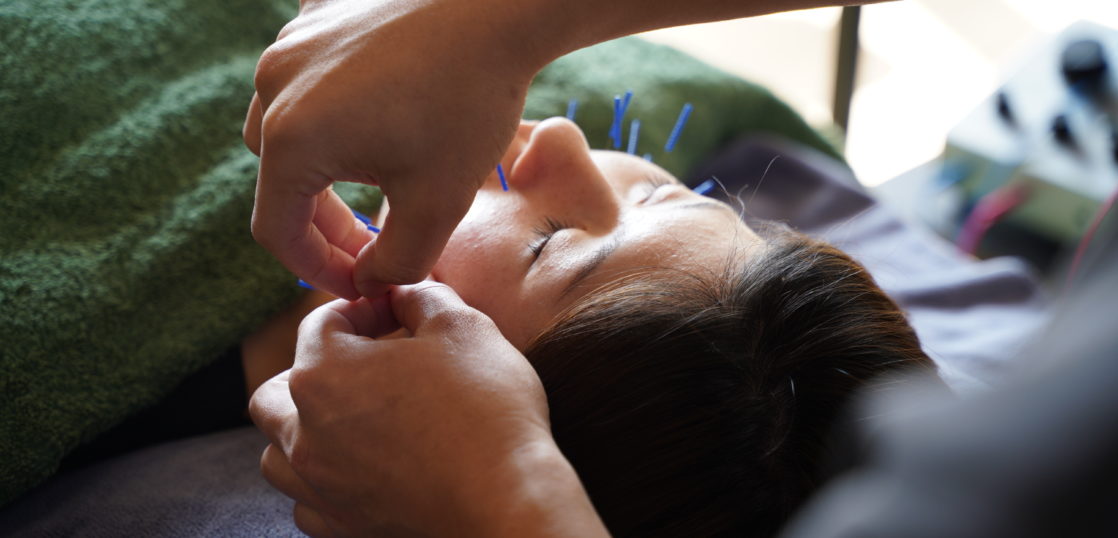 Beauty acupuncture and moxibustion