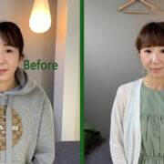 30代女性美容鍼灸Before＆After